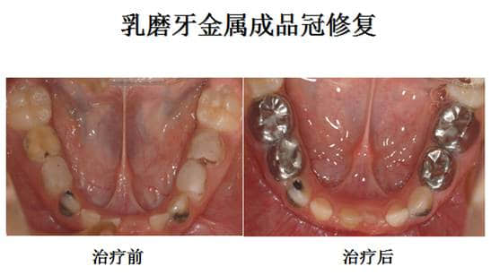 003tXCM2gy6Lz5qv6FG78.jpg