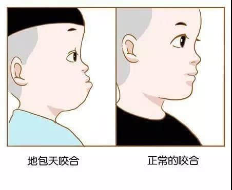地包天.jpg