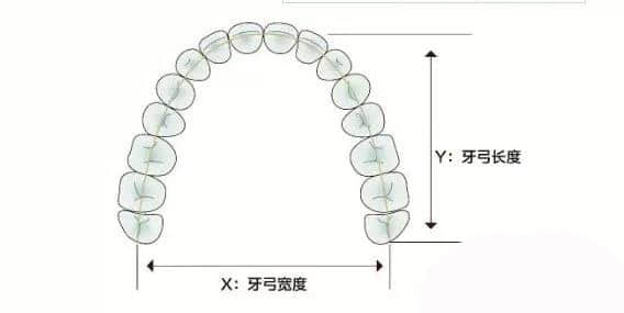 牙弓1.jpg