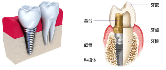 129-1P531151200147.png